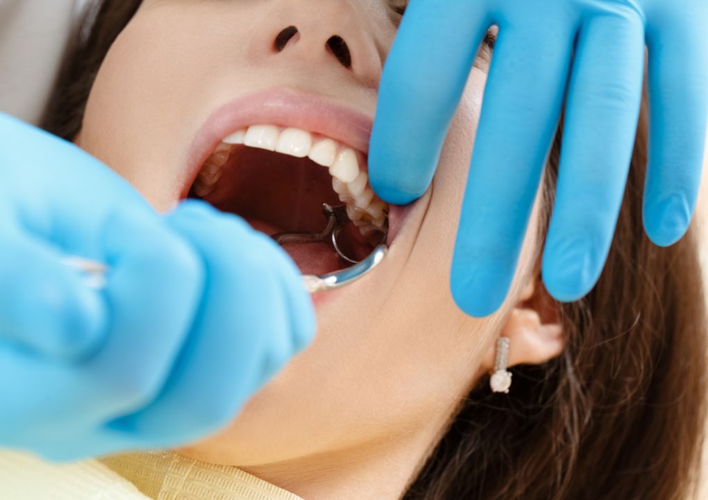 Professional Wisdom Teeth Removal Near Me